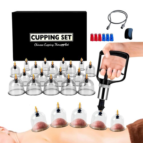 Cupping therapy set - set, 18