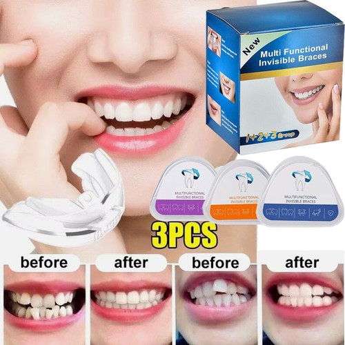 Stage dental orthodontic - stage,