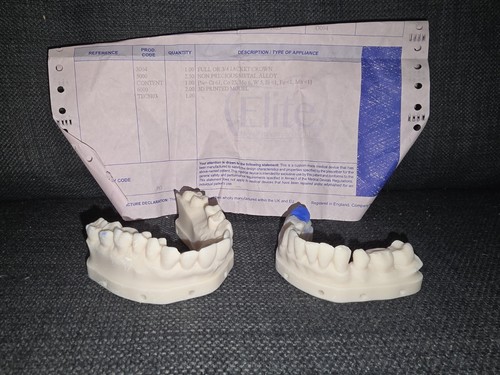 Printed dental jaw models - dental,