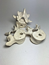 Vintage Anatomical Part Human Bones Scientific Resin Model 3 Life Size Vertebrae
