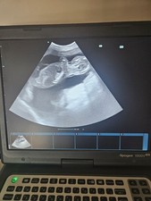 Siui Apogee Lite1000 Colour Doppler Veterinary Ultrasound Machine & Transducer