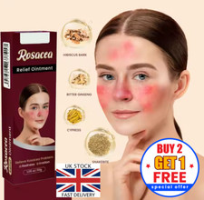30g Rosacea Cream  Itching flaking skin Red Face Discomfort irritation Skin