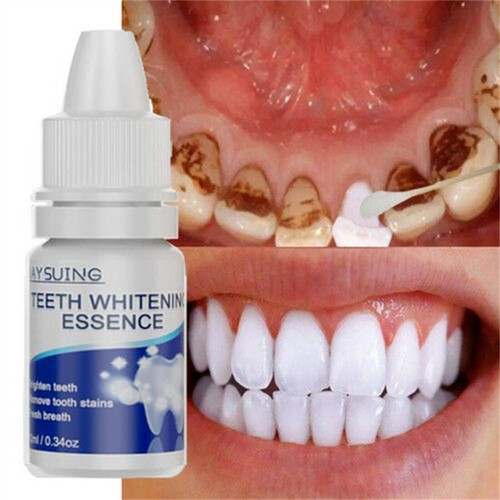 Teeth whitening essences extra - teeth,