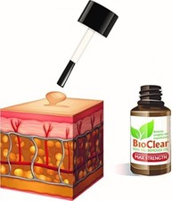 BIO CLEAR SKIN TAG WART