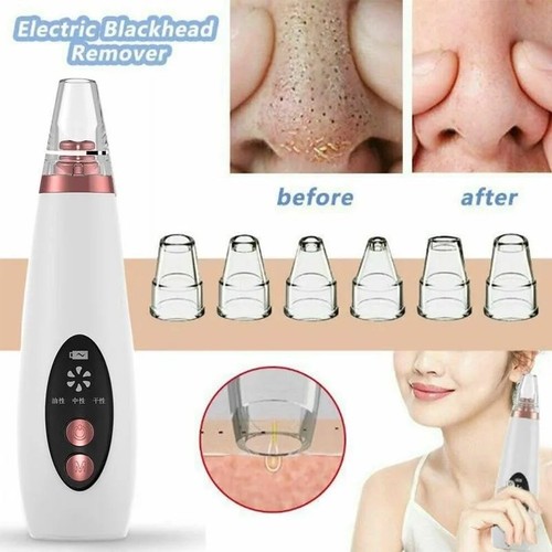 Blackhead remover machine - blackhead,