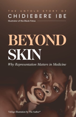 Beyond skin why - why, representation