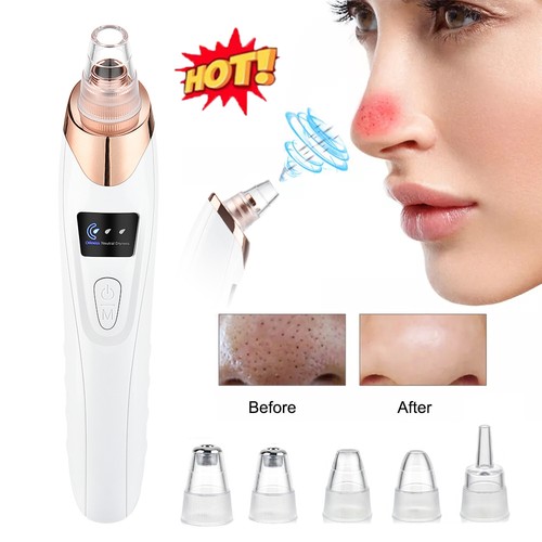 Electric facial blackhead - electric,