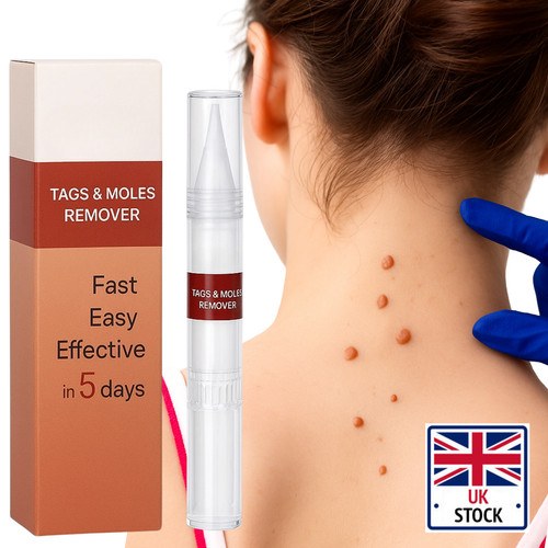 Wart remover liquid skin - remover, tag