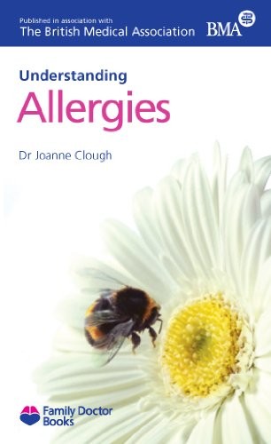 Allergies - , (understanding)