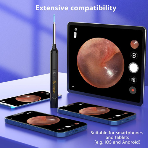 Ear wax removal kit - ear, camera