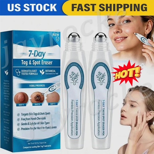 Skin tag remover - skin,