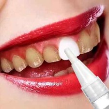 NEW DENTAL ORAL + WHITE XTRA STRONG TEETH TOOTH WHITENING GEL PEN BRUSH WHITENER