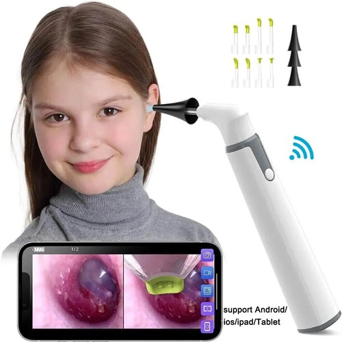 Wireless otoscope with camera - wireless,