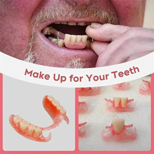 Diy fake teeth - diy, denture