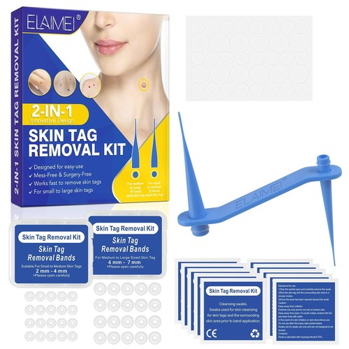 Skin tag removal - removal, small