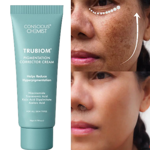 Kojic acid face cream - kojic,