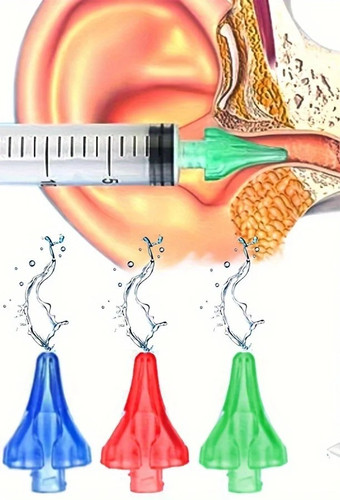 Ear wax removal syringe kit - ear,