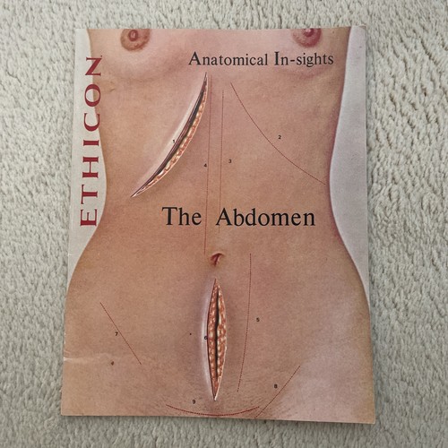 Ethicon anatomical insights - ethicon,