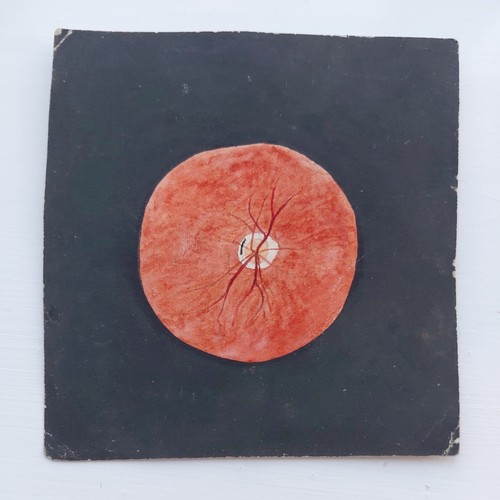 Rare 1866 netley army - 1866, medical