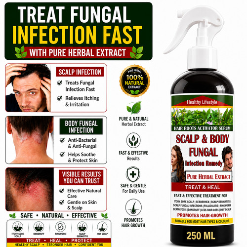 Stop psoriasis eczema atopic - psoriasis,