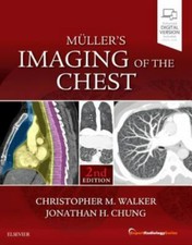 Muller's Imaging of the Chest: Expert Radiology Series Walker Chung Hardback 2e