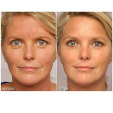 INSTANT FACE LIFT ANTI WRINKLE