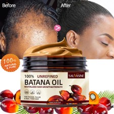 Batana Oil For Hair Growth