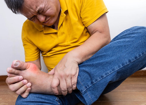 Gout - gout, arthritis)