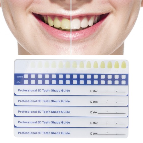 5pcs teeth whitening shade - teeth,