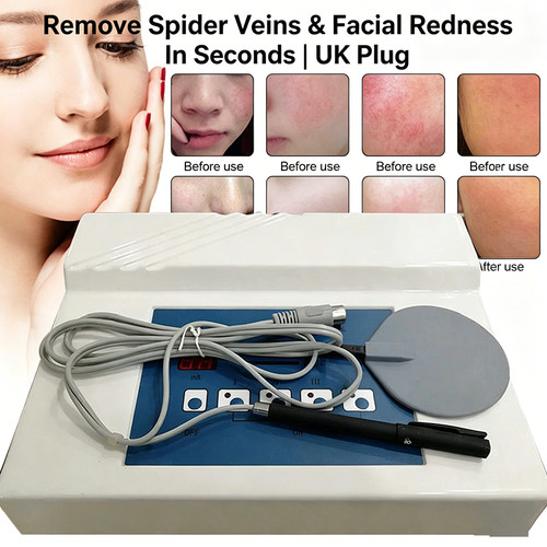 Spider vein remover high - vein,