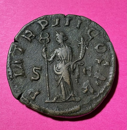 Amazing condition philip the - condition,