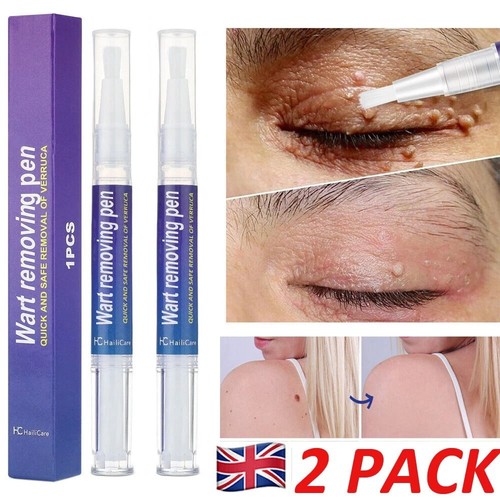2pcs hours wart - 2pcs, 12