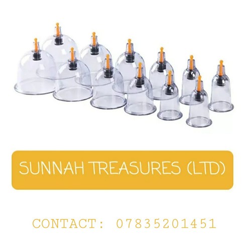 100 hijama cupping cups - hijama/cupping,