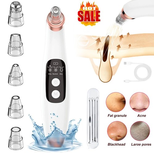Electric blackhead remover - electric,