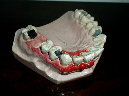 Rare antique anatomical - antique,