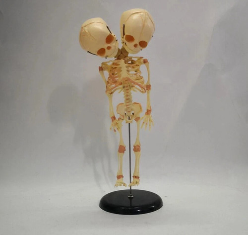 Fetal fetus skeleton teaching - fetus,