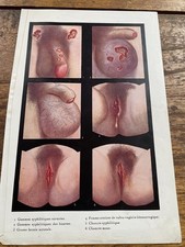 Antique Medical Illustration