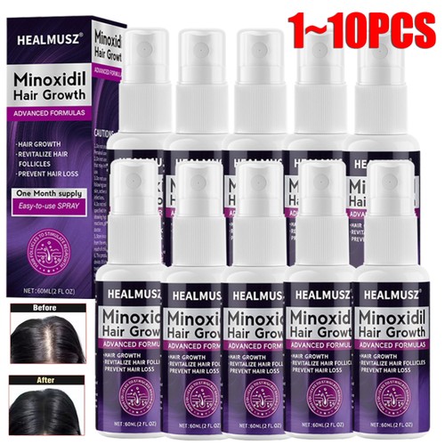 Minoxidil spray hair loss - hair,