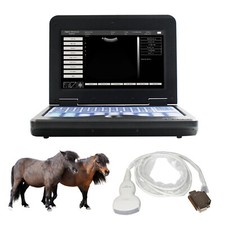 Portable Ultrasound Scanner