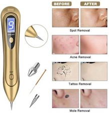 LCD Laser Plasma Skin Tag