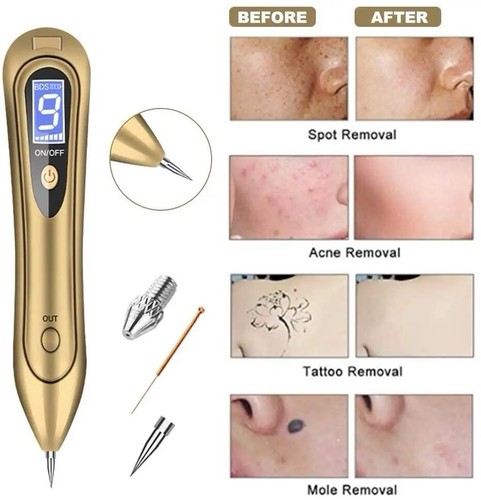 Lcd laser plasma - skin, tag