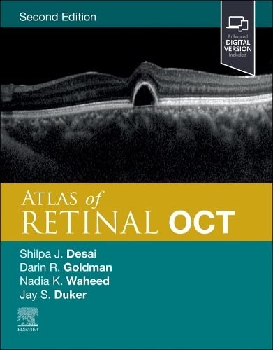 Atlas retinal oct optical - oct:,