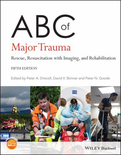 Abc ser major - of, trauma