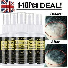 Minoxidil hair regrowth - minoxidil,