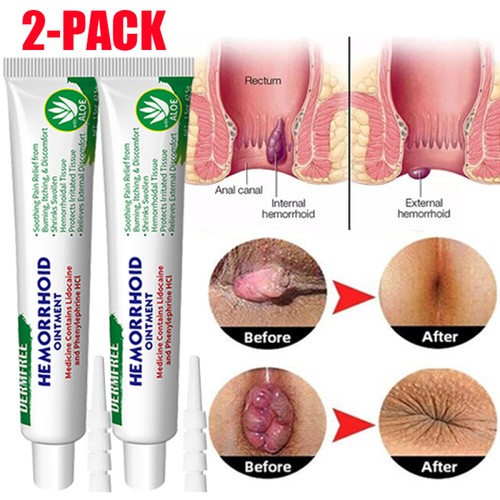 2pcs herbal haemorrhoid cream - 2pcs,