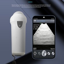 Wireless Veterinary Ultrasound