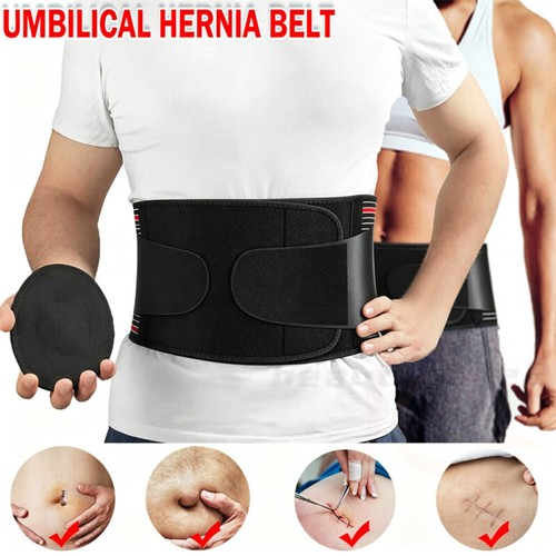 Umbilical hernia support - umbilical,