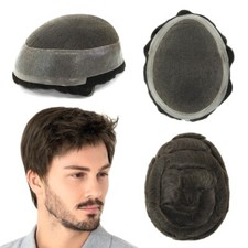 Mens Hair Replacement