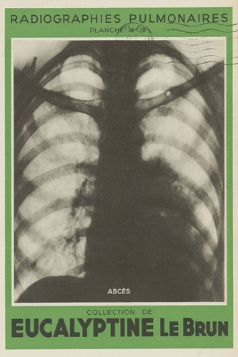 Vintage medical poster - poster,
