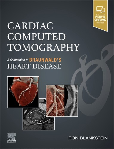 Cardiac computed tomography - cardiac,